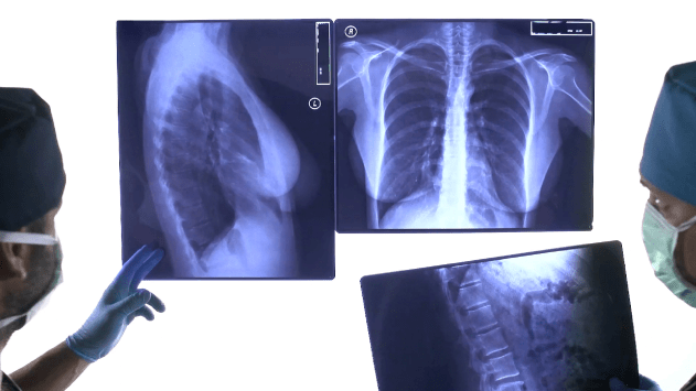 Radiología - rayos-x